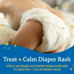 A+D Medicated Diaper Rash Cream with Zinc, 4oz